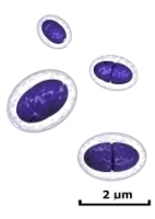 encapsulated pneumococcus